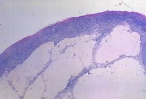 Involuzione . Ovaio di donna giovane in cui i follicoli oofori sono numerosi.De Agostini Picture Library