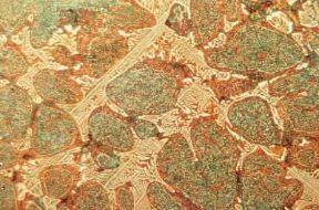 Lega. Acciaio per utensili rapido: la struttura Ã¨ costituita da un reticolato di carburi ledeburitici immersi in una matrice di bainite globulare e austenite residua.De Agostini Picture Library