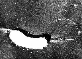 Colera. Vibrione al microscopio.De Agostini Picture Library