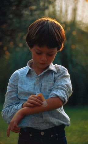 Le lesioni cutanee. Abrasione. Provocate prevalentemente da piccoli traumi, le lesioni cutanee, anche molto superficiali come le escoriazioni, possono rappresentare una via d'accesso al nostro organismo da parte di germi patogeni. 