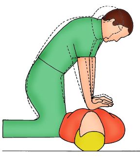 Rianimazione cardiopolmonare. La posizione delle spalle. Rianimazione cardiopolmonare. Per effettuare il massaggio cardiaco, le spalle devono essere perpendicolari al torace del paziente.