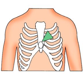 Massaggio cardiaco: il punto di compressione. Rianimazione cardiopolmonare. Punto di compressione per il massaggio cardiaco.