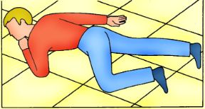 Posizione di sicurezza nella perdita di coscienza. Perdita di coscienza. In assenza di trauma alla colonna ed in presenza di respiro e circolazione, ponete il paziente nella posizione laterale di sicurezza.