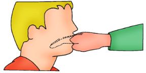 Come stimolare il vomito. Avvelenamento da funghi. Stimolazione al vomito con le dita.