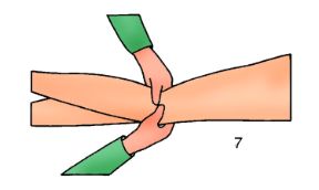 Punto di compressione arteriosa in caso di ferita sotto il ginocchio. La compressione arteriosa. In caso di ferita sotto il ginocchio (polpaccio) si comprime all’incavo del ginocchio con il pollice.