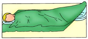 Emorragia interna: prevenire lo shock. Emorragie interne. Adagiare l'infortunato in posizione antishock.