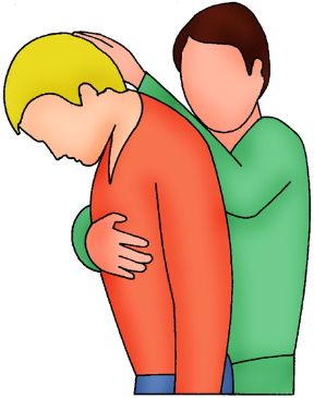 Intervento in caso di ferite al volto. Soffocamento. In caso di ferite al volto bisogna evitare che il soggetto colpito soffochi a causa del sangue che tende a ristagnare nella gola. A questo scopo bisogna piegare in avanti il capo del paziente o, se è incosciente, metterlo in posizione laterale di sicurezza.