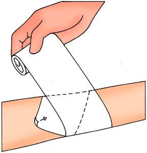 Effettuare una corretta fasciatura: inizio della fasciatura. Come fare una fasciatura. Fate il primo giro leggermente obliquo.