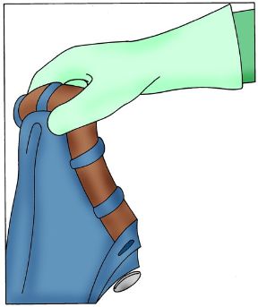 Intervento in caso di ustione da caustici. Rimozione degli indumenti. Ustioni da custici. Preoccupatevi di togliere gli indumenti contaminate dalle sostanze tossiche, proteggendo le mani con guanti di gomma.