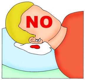 Intervento in caso di otorragia: non fermate l'emorragia. Otorragia. Non cercate di fermare l’otorragia; non lavate l’orecchio né mettetegli dentro alcunché.