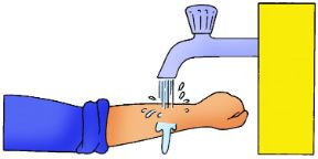 Morsi di altri animali. Lavare la ferita. Morsi di altri animali. Se si tratta di un morso superficiale, lavate la ferita con abbondante acqua e sapone.