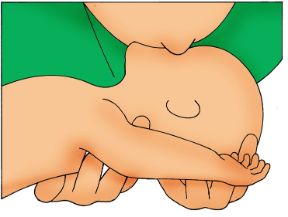 Primo soccorso per i bambini: respirazione artificiale. Primo soccorso per neonati e bambini. Se il bambino non respira iniziate la respirazione artificiale.