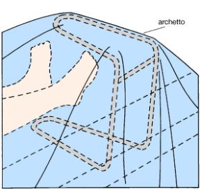 Organizzare la stanza del malato: archetto alzacoperte. La stanza del malato. Per evitare che biancheria e coperte pesino troppo su una parte del corpo del malato è utile un archetto.