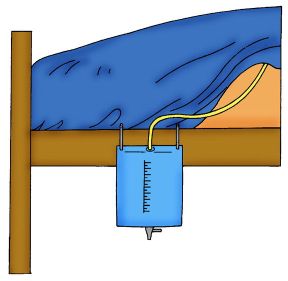 Utilizzo del catetere vescicale. Cateterismo vescicale. In caso di forme di incontinenza di grave entità, si può ovviare alla mancanza di controllo sfinterico con l'introduzione di un catetere vescicale.