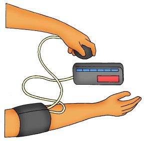 Misuratori automatici di pressione. I misuratori automatici. Esistono in commercio anche apparecchi automatici. Con essi è sufficiente posizionare correttamente il manicotto, gonfiarlo, o attivare il meccanismo di gonfiaggio automatico. 