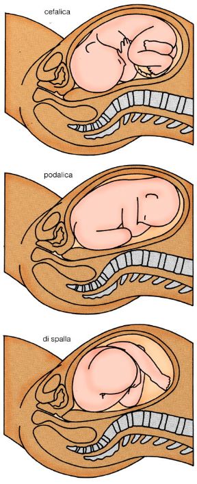 Il feto nell'ultimo trimestre. Presentazione del feto. Durante l'ultimo trimestre di gravidanza il feto si posiziona definitivamente. Al momento del parto la sua presentazione (cefalica, podalica o di spalla) potrà determinare se il parto può svolgersi spontaneamente o meno.