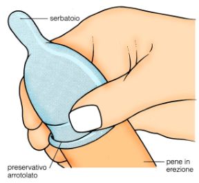 Come utilizzare il profilattico. Profilattico. Durante i rapporti sessuali il profilattico svolge una doppia funzione: può essere utilizzato sia come metodo anticoncezionale, sia come misura preventiva quando si teme il contagio da malattia trasmissibile per via sessuale. Perché il profilattico sia efficace, deve essere srotolato sul pene già eretto prima di iniziare la penetrazione, stringendo il serbatoio tra le dita affinché non si riempia di aria. Va posta attenzione a non lacerare il profilattico con le unghie e a estrarlo trattenendolo alla base del pene ancora eretto, perché non fuoriesca liquido seminale dopo il rapporto. Prima dell'uso i profilattici vanno conservati al riparo da fonti di calore (nel portafoglio si danneggiano), va sempre controllata la loro data di scadenza, riportata sulla confezione e ogni profilattico va utilizzato una volta sola.