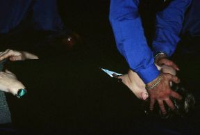 Verifica della presenza di fratture alla testa. L'esame dalla testa ai piedi. Bisogna effettuare una completo esame di tutto il corpo per rilevare eventuali segni di traumi, non evidenti a prima vista. 