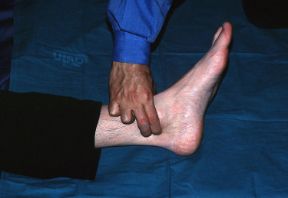 Rilevazione del polso tibiale posteriore. Rilevazione del polso tibiale posteriore. In caso di fratture agli arti inferiori va ricercato il polso tibiale posteriore per rilevare un eventuale deficit della circolazione.