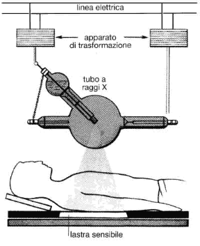 Figura 22.3 Esame radiografico: i raggi X attraversano il corpo e colpiscono la lastra sensibile. Se incontrano strutture capaci di intercettarli, come per esempio le ossa, o corpi estranei, le parti sottostanti della lastra non vengono impressionate e rimangono bianche, mentre le altre appaiono scure. Modulazione di ampiezza Modulazione di frequenza