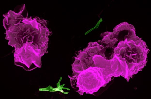 batteri-tubercolosi-macrofagi-(1)