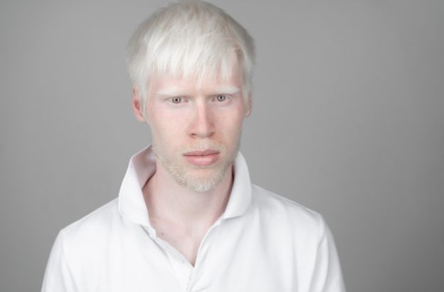 albino.jpg