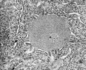 Microfotografia elettronica del virus della rabbia La rabbia è una malattia infettiva sostenuta da un virus filtrabile che si localizza nel sistema nervoso centrale. È propria di alcuni mammiferi (cani e lupi, ma anche gatti, volpi, equini, bovini, suini ecc.) e viene trasmessa con la morsicatura, mediante l'innesto di saliva contenente il virus. 