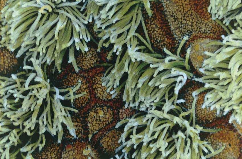 mucosa della trachea Mucosa della parete della trachea al microscopio.
© De Agostini Picture Library